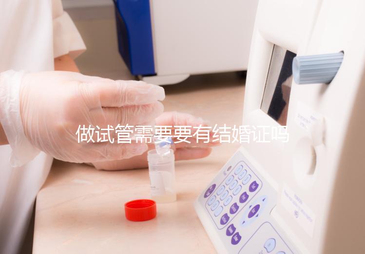 做試管需要要有結(jié)婚證嗎？做試管需要結(jié)婚證