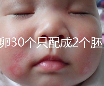 取卵30個只配成2個胚胎別放棄！卵巢傷口小移植成功率不低