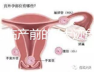 二胎臨產(chǎn)前的7大跡象，出現(xiàn)見(jiàn)紅、陣痛別大意