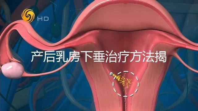 產(chǎn)后乳房下垂治療方法揭秘，按摩手法再好也沒提前預(yù)防有用