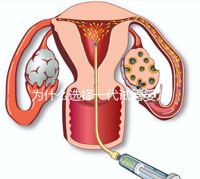 為什么選擇一代試管嬰兒？全面解析其獨特優勢與適用場景