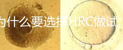 為什么要選擇HRC做試管？這6大優(yōu)勢看完就知道答案