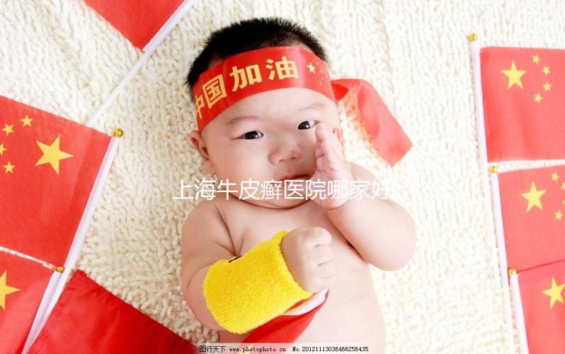 上海牛皮癬醫院哪家好