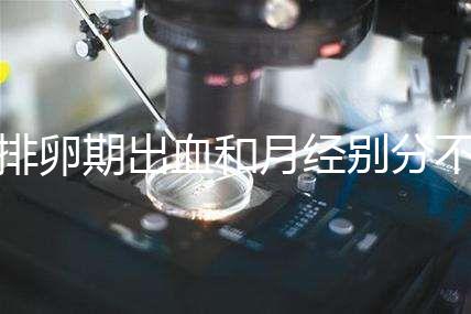 排卵期出血和月經別分不清,4大區別輕松判斷