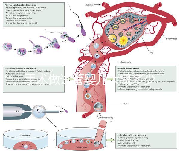 手術做試管嬰兒大概多少錢（手術做試管嬰兒大概多少錢啊）