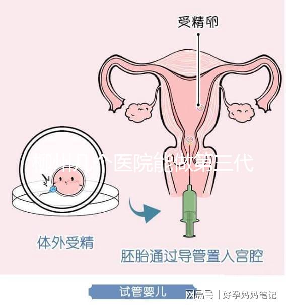 柳州幾個(gè)醫(yī)院能做第三代試管嬰兒?詳細(xì)的費(fèi)用成功率都在這