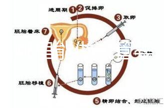 文昌哪里能做試管嬰兒？國內做一次成功率有多高？