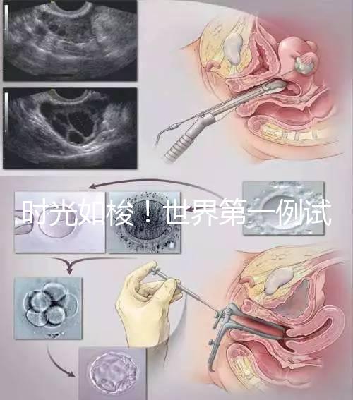 時光如梭！世界第一例試管嬰兒路易絲·布朗已經(jīng)41歲啦