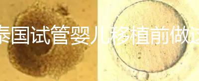 泰國試管嬰兒移植前做這3件事能提高成功率，不然會后悔！