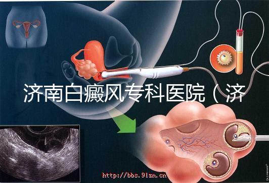 濟(jì)南白癜風(fēng)專科醫(yī)院（濟(jì)南白點(diǎn)癲風(fēng)醫(yī)院排名）
