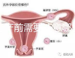 孕婦產(chǎn)前需要注意哪些事項？