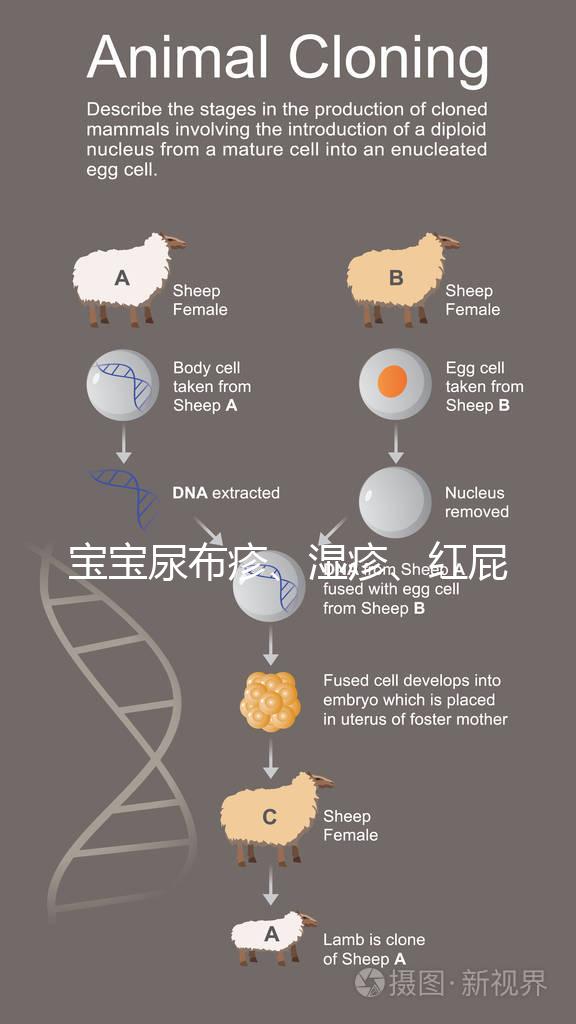 寶寶尿布疹、濕疹、紅屁股傻傻分不清？4點區別輕松診斷