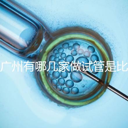 廣州有哪幾家做試管是比較靠譜的,最近有打算?