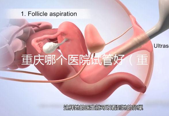 重慶哪個(gè)醫(yī)院試管好（重慶哪個(gè)醫(yī)院試管好一點(diǎn)）
