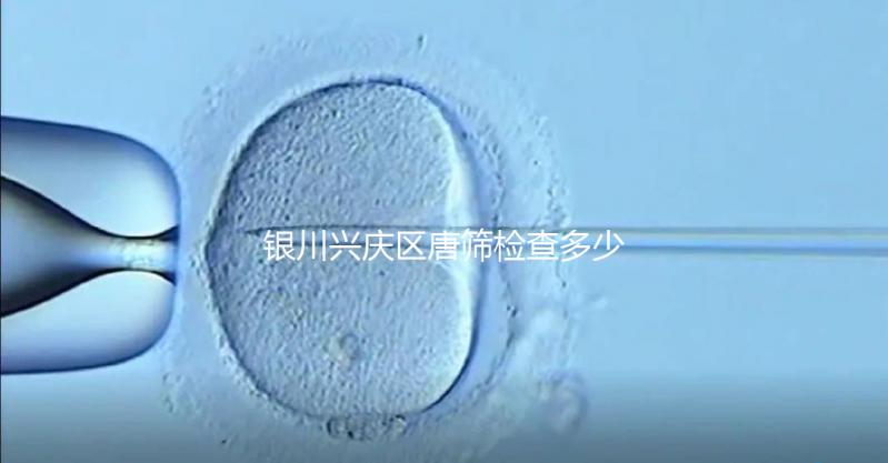 銀川興慶區(qū)唐篩檢查多少錢取決于情況，2024年國家免費限額