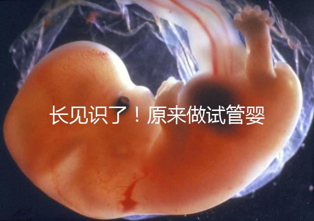 長見識了！原來做試管嬰兒，精子是這樣被篩選出來的