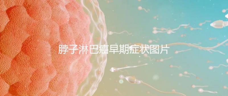 脖子淋巴癌早期癥狀圖片(脖子上有結節(jié)的圖片)