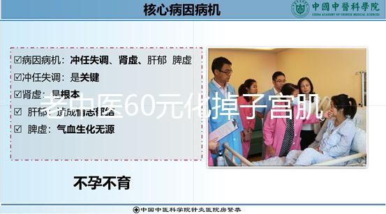 老中醫60元化掉子宮肌瘤偏方一覽，三棱效果怎樣用了就造