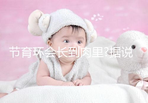 節(jié)育環(huán)會長到肉里?據說這是有一定依據的