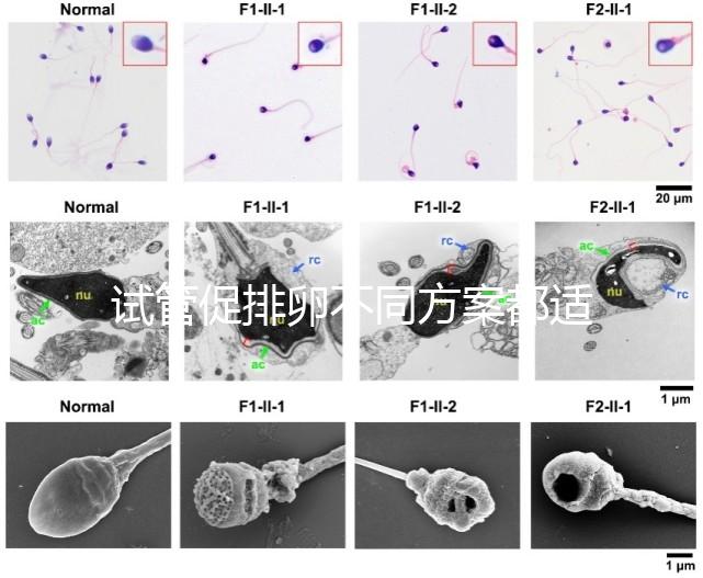 試管促排卵不同方案都適合哪些人？如何監測排卵？