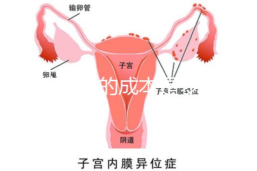 試管嬰兒的成本是多少？需要多少錢(qián)？