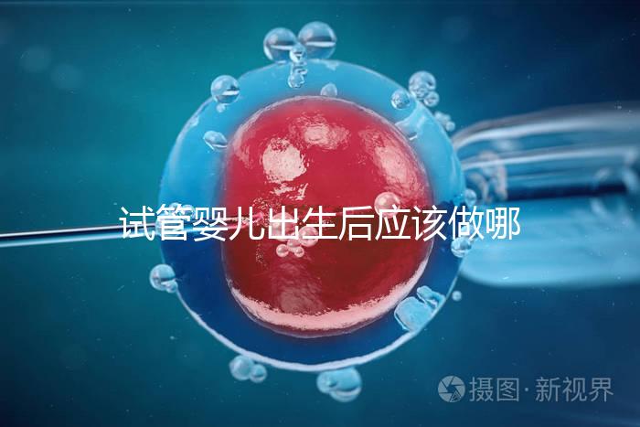 試管嬰兒出生后應該做哪些檢查答案?DR應該看情況嗎?