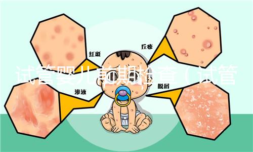 試管嬰兒前期檢查（試管嬰兒前期檢查項目和流程）