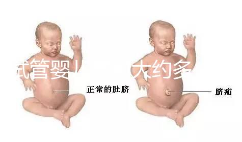 試管嬰兒費(fèi)用大約多少2021年：一二三代試管分別指的是什么？