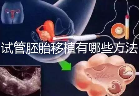 試管胚胎移植有哪些方法?