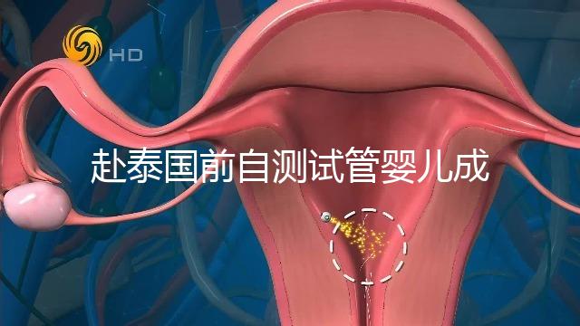 赴泰國前自測試管嬰兒成功率，這些方法值得收藏