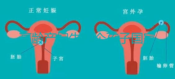 高齡產(chǎn)婦生八個孩子國家有補助?有沒有違法才是關(guān)鍵