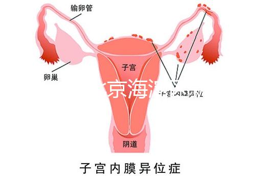 2024年北京海淀區新生兒醫療保險處理策略，照片要求不要出錯
